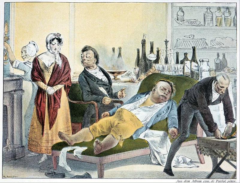 Apoplexy: Losing Everything in a&nbsp;Stroke